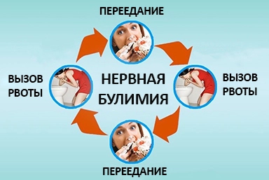 Лечение булимии в Солнечногорске